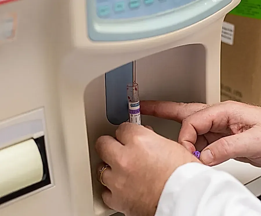 Mão de jaleco encaixando um tubo de coleta de sangue com tampa roxa no analisador de hematologia do laboratório.